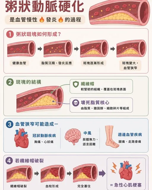 血管內賊 2 號：血脂報告，最重要的是 LDL